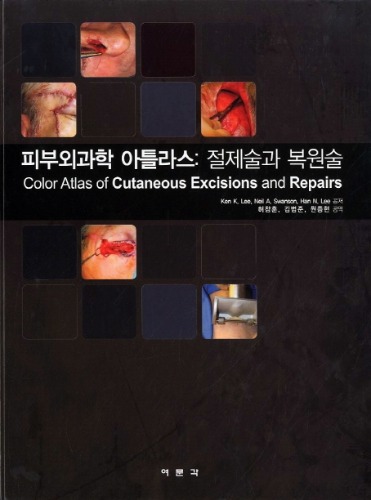 피부외과학 아틀라스:정제술과 복원술